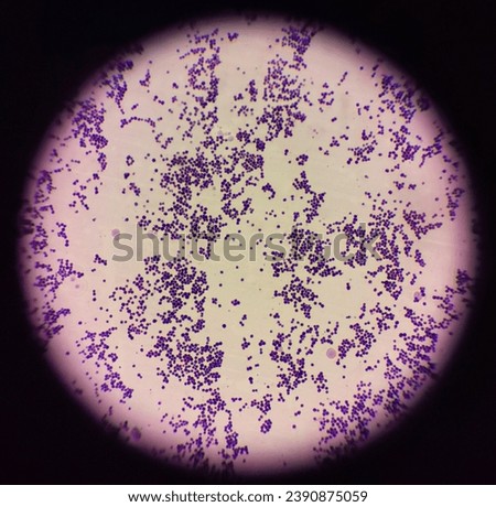 Gram stain of the bacterium, Staphylococcus aureus. This bacteria is gram positive, as such it appears purple after staining due to the thick peptidoglycan. The round cells are also seen in clusters.