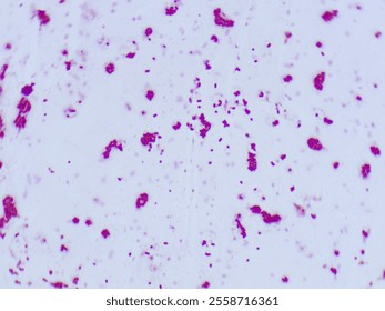 Gram stain microscopic view of enterococcus faecalisi which is 100X zoom and captured with light microscope