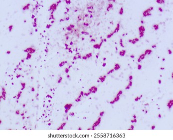 Gram stain microscopic view of enterococcus faecalisi which is 100X zoom and captured with light microscope