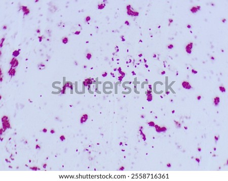 Gram stain microscopic view of enterococcus faecalisi which is 100X zoom and captured with light microscope