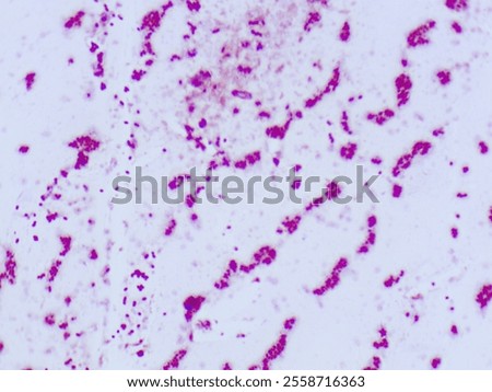 Gram stain microscopic view of enterococcus faecalisi which is 100X zoom and captured with light microscope