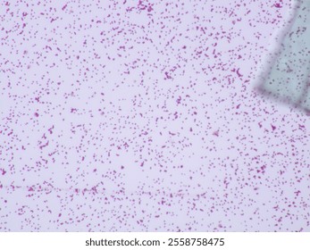 Gram stain microscopic view of staphylococcus aureus which is 40X zoom and captured with light microscope