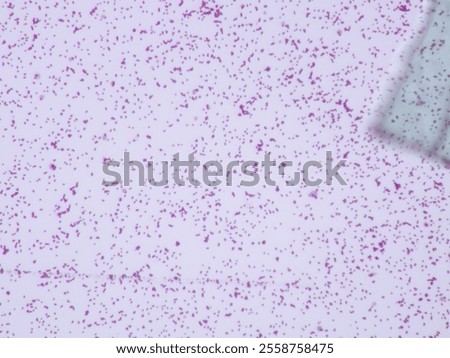 Gram stain microscopic view of staphylococcus aureus which is 40X zoom and captured with light microscope