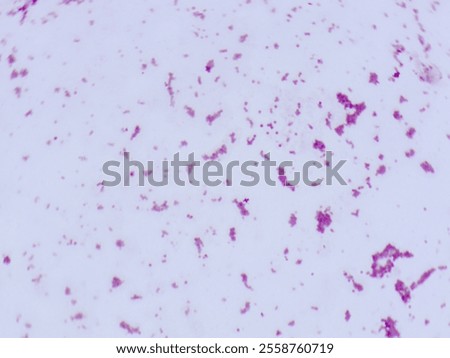 Gram stain microscopic view of streptococcus agalactiae which is 100X zoom and captured with light microscope