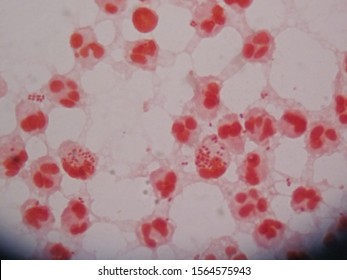 Gram Stain For Neisseria Gonorrhoeae