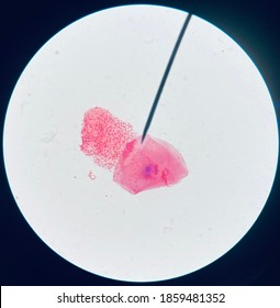 Gram Stain Of Oral Biofilm 