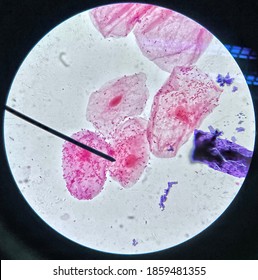 Gram Stain Of Oral Biofilm 