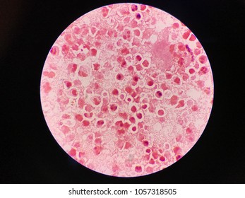 Gram Stain Neisseria Gonorrhoeae Urethral Discharge Stockfoto Shutterstock