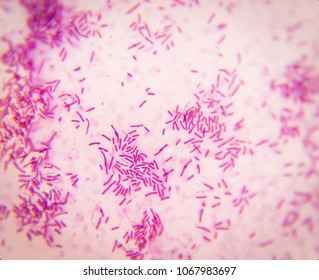 Gram staining of Bacteria Under Microscope