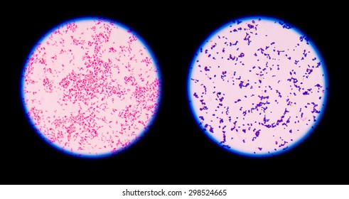 Gram staining, also called Gram's method, is a method of differentiating bacterial species into two large groups (Gram-positive and Gram-negative).