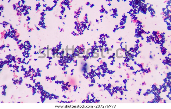 Gram Staining Called Grams Method Method Stock Photo (Edit Now) 287276999