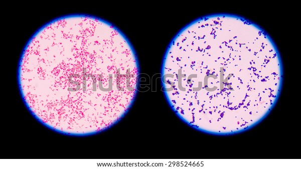 Gram staining, also called Gram\'s method,\
is a method of differentiating bacterial species into two large\
groups (Gram-positive and\
Gram-negative).