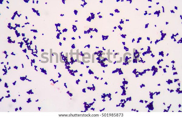 Gram Staining Called Grams Method Method Stock Photo 501985873 ...