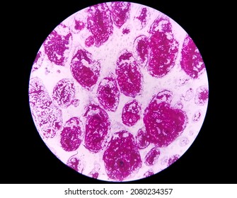 57 Colonies mycobacterium tuberculosis Images, Stock Photos & Vectors ...