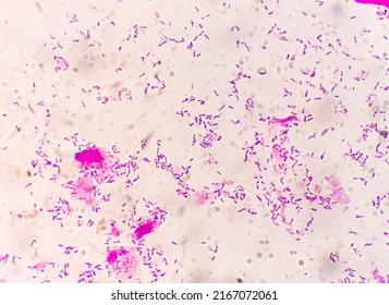 Gram staining, also known as Gram's method, is a method of differentiating bacterial species into two large groups (Gram positive and Gram negative).