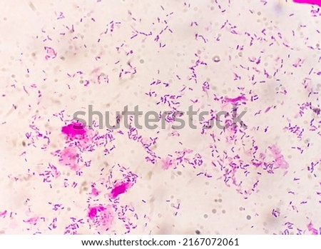 Gram staining, also known as Gram's method, is a method of differentiating bacterial species into two large groups (Gram positive and Gram negative).