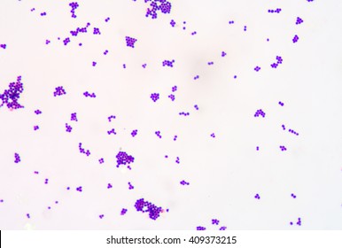 Gram Staining Gram Positive Cocci Pari Stock Photo 409373215 | Shutterstock