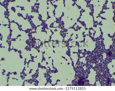 Gram staining of Staphylococcus aureus under microscopes