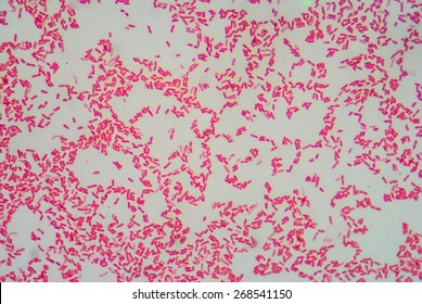 Gram Staining,Negative Bacilli.