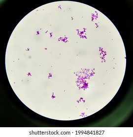 Gram-positive Bacteria Streptococcus Pyogenes Which Cause Scarlet Fever And Other Infections, 