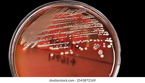 Gram-positive, to Gram-variable, nonmotile, Coccus, beta hemolysis, saprotrophic bacterium that belongs to the family Staphylococcus growth on blood agar.