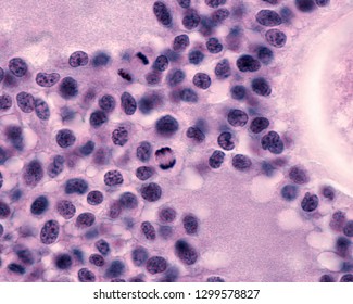 Granulosa Cells Of The Cumulus Oophorus Of A Antral Ovarian Follicle. These Cells Are Actively Proliferating And Thus Show Many Mitosis.