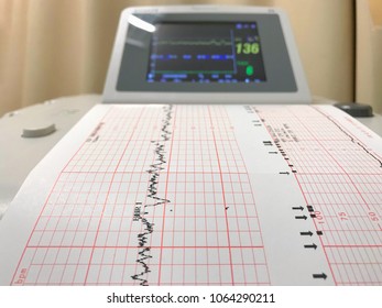 Graph Report To Monitoring Baby Movement And Checking Mom Hart Rate And Pressure. Healthy.