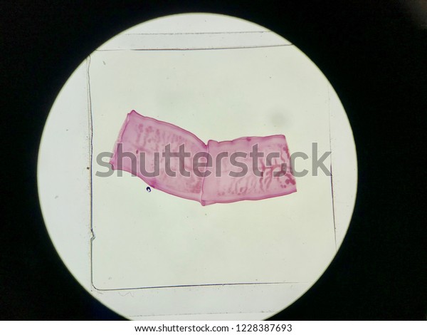 Gravid proglottid\
of tenia in light\
microscope