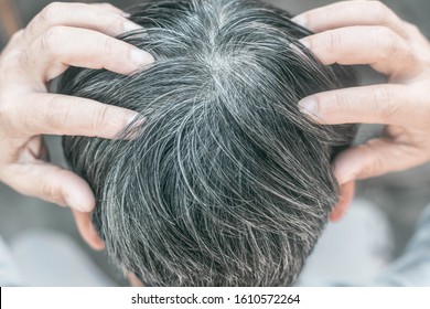 Gray Hair On The Head. Backside Portrait Of Man. Gray Hair Problems In Men. Hair Dye Product Concept.