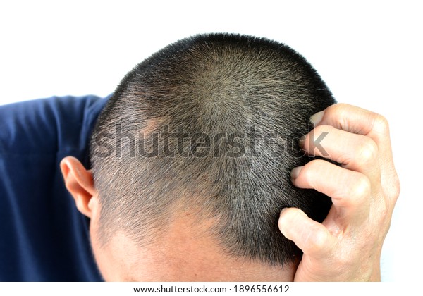Gray hair problems in men, asian man with\
gray hair, white hair or hair loss\
problem.