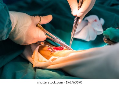 Greater Saphenous Vein Harvest For Venous Conduit