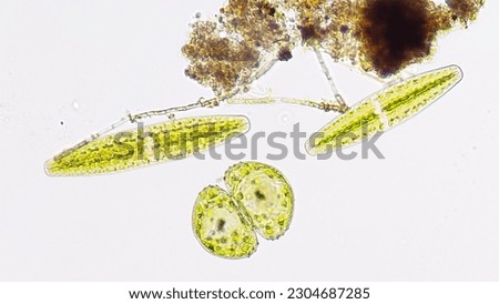 A green algae or phytoplankton belonging genus Netrium and Cosmarium. 100x magnification. Selective focus