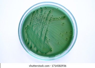 Green Colonies Of Vibrio Parahaemolyticus Bacteria Growth On TCBS Agar Plate With White Background