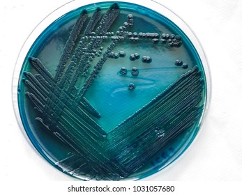 The Green Colony Of Vibrio Parahaemolyticus On Thiosulphate Citrate Bile Salt Sucrose (TCBS) Agar.