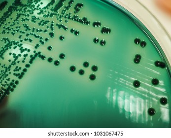 The Green Colony Of Vibrio Parahaemolyticus On Thiosulphate Citrate Bile Salt Sucrose (TCBS) Agar.