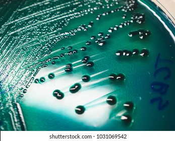 The Green Colony Of Vibrio Parahaemolyticus On Thiosulphate Citrate Bile Salt Sucrose (TCBS) Agar.