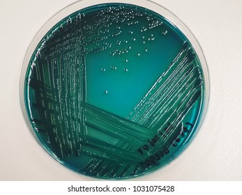 The Green Colony Of Vibrio Parahaemolyticus On Thiosulphate Citrate Bile Salt Sucrose (TCBS) Agar.