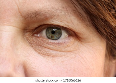 Green Eye With Brown Spots On The Face Of An Elderly Woman, Small Wrinkles On The Eyelids, Overhang, The Concept Of Age-related Changes In Human Skin