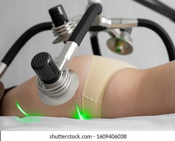 Green Medical Laser On A Girl's Body