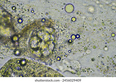 green mucus and coughing up phlegm under the microscope looking at influenza cells and cold snot from a human who is sick in australia - Powered by Shutterstock