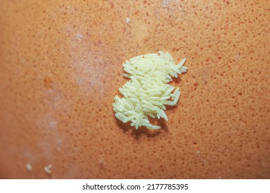 Greenbottle Fly Eggs, Flies Eggs On Rotten Chicken Egg