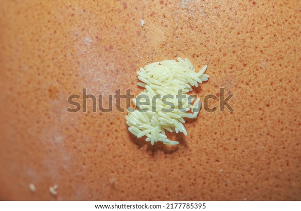 Greenbottle\
fly Eggs, Flies Eggs on rotten chicken\
egg