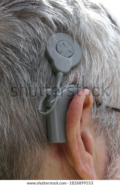 grey cochlear implantclose up, therapy, hearing, behind\
the ear, Cochlear implant system. Hearing impairment in deaf\
patients 