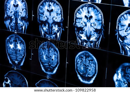 A group of CAT scans of the human brain closeup