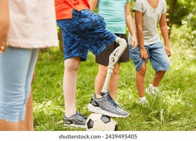 Group of children playing with soccer ball with boy with prosthetic leg in summer - Powered by Shutterstock