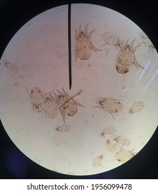 Group Of House Dust Mites From Microscope