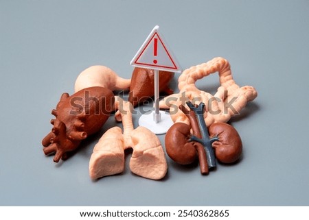 A group of human model organs and warning sign. Organ failure, general health awareness concept.