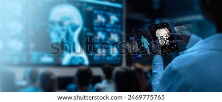 A group of medical professionals reviewing and analyzing detailed brain scans displayed on digital screens and tablets, highlighting advanced  AI medical imaging technology.