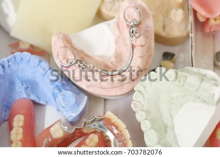 group partial metal denture or removable prosthesis, Temporary plate