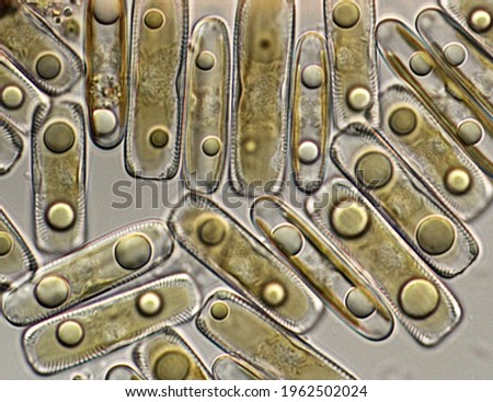 Group of pennate diatoms, single celled organisms (protista) with lipid droplets, golden plastids, and glassy (silica) shell (frustule). Light microscope image of living cells.